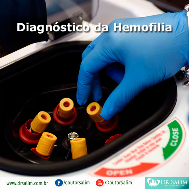 Quais são os exames que detectam a hemofilia?