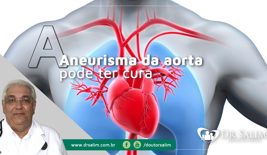 Aneurisma da aorta, doença grave com chance de cura com detecção precoce