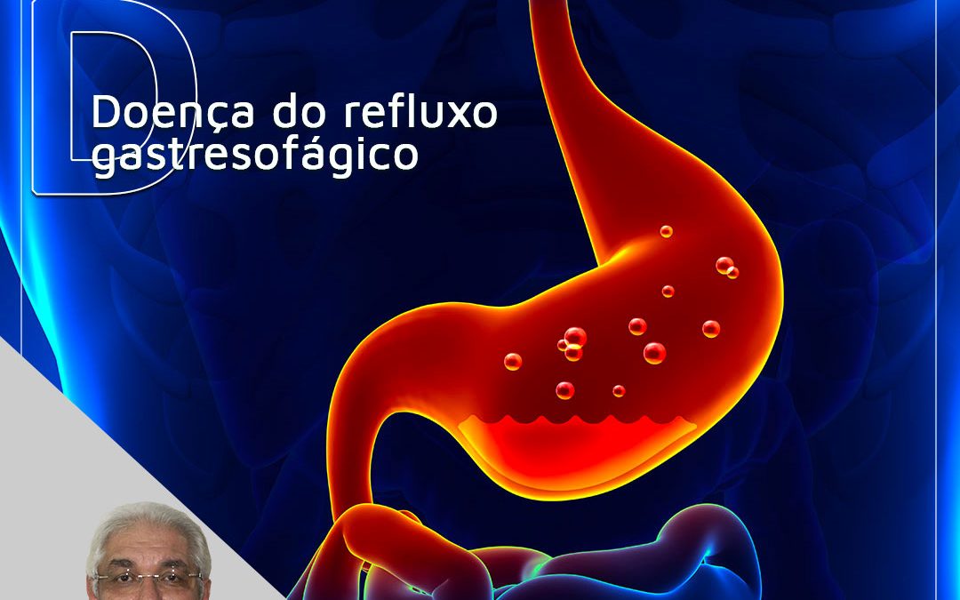 Doença do refluxo gastresofágico (DRGE)
