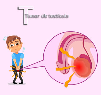 Tumor do testículo