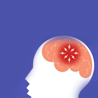 Epilepsia, causas e sintomas